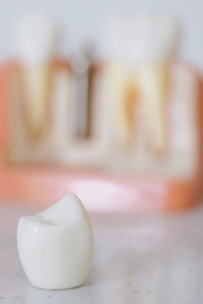   dental crowns